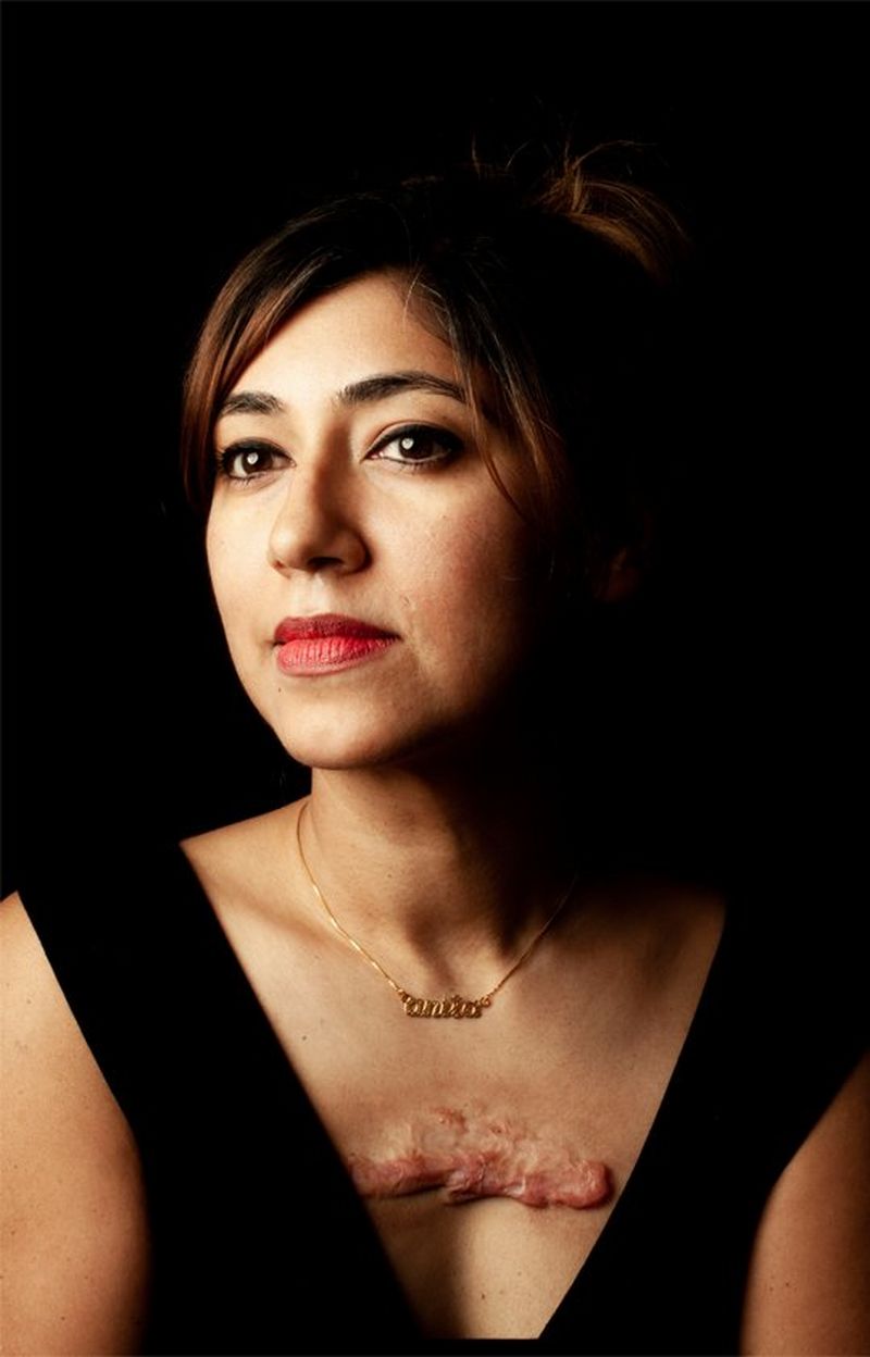 Behind the Scars Canon Ireland